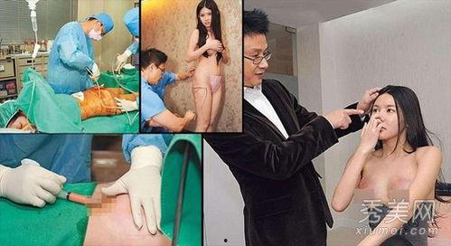 整形手术爆料视频大全,爆料视频大全深度解析  第3张